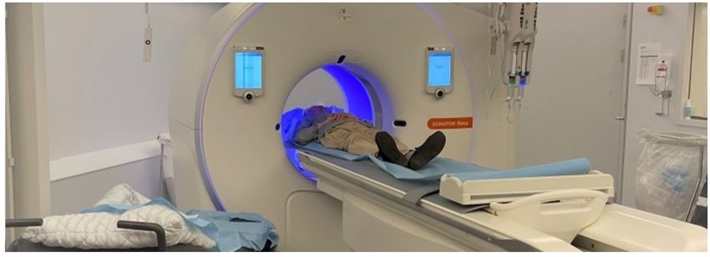 CT-scanning.