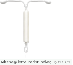 Mirena® intrauterint indlæg