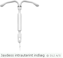 Jaydess intrauterint indlæg