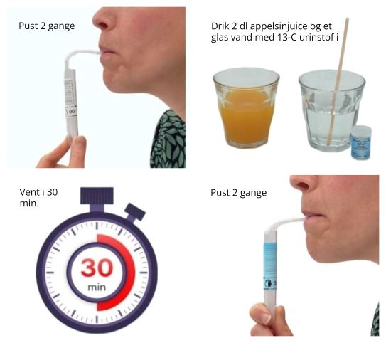 Instruktion i at lave helecobaktorpusteprøve. Pust to gange. Drik 2 dl. appelsinjuice og vand tilsat urinstof. Vente 30 minutter. Pust 2 gange igen. Prøven sendes videre til et laboratorium.