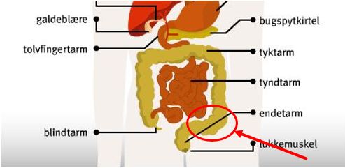 Colon sigmoideum